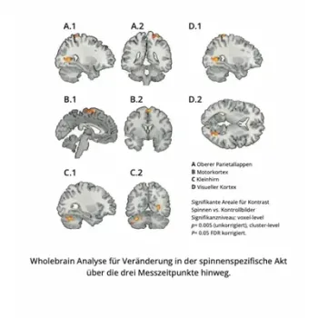 Wholebrain